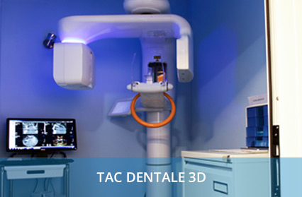 Home Trattamenti Tac Dentale 3d